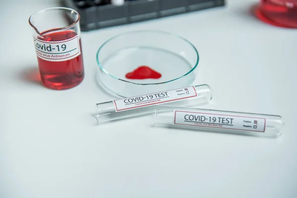 Coronavirus Covid19 Geïnfecteerd Bloedmonster Monsterbuis Tafel Corona Virus Laboratorium — Stockfoto