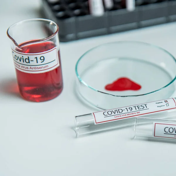 Coronavirus Covid19感染血样在Corona病毒实验室桌上的试管中 — 图库照片