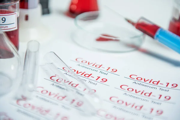 코로나 바이러스 실험실에 튜브에서 샘플을 코로나 바이러스 — 스톡 사진