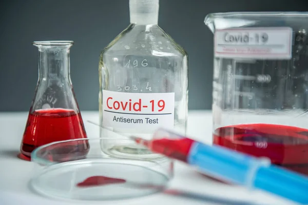 コロナウイルス検査室のテーブルの上のサンプルチューブに感染した血液サンプル19 — ストック写真