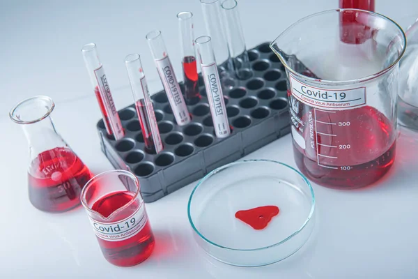 コロナウイルス検査室のテーブルの上のサンプルチューブに感染した血液サンプル19 ストックフォト