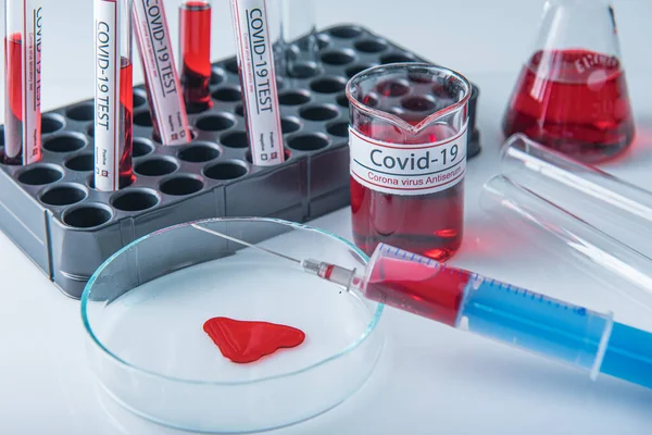 コロナウイルス検査室のテーブルの上のサンプルチューブに感染した血液サンプル19 ロイヤリティフリーのストック画像