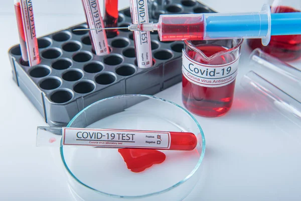 Ιός Του Coronavirus Covid19 Μολυσμένο Δείγμα Αίματος Σωλήνα Δείγματος Στο Royalty Free Φωτογραφίες Αρχείου