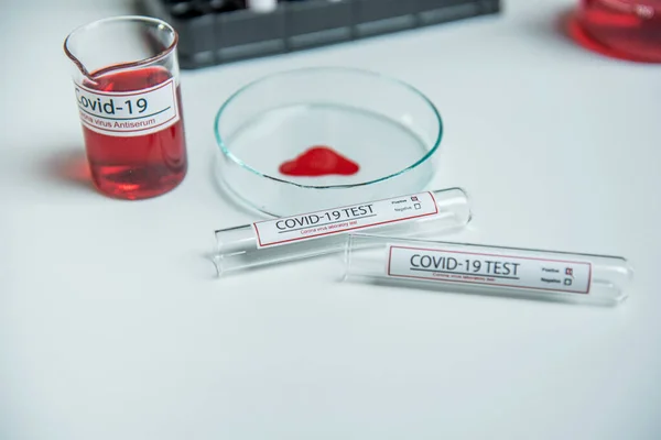 Coronavirus Covid19 Infected Blood Sample Sample Tube Table Corona Virus Stock Image