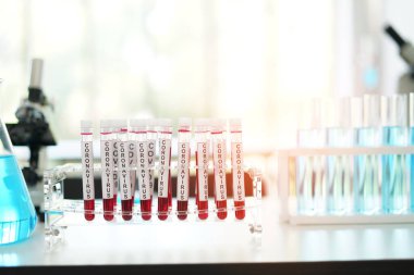 Coronavirus covid 19, araştırmacılar korona virüsü aşısını yok etmenin yollarını arıyor. Covid virüs araştırma uzmanları için test tüpü ile kan testleri 