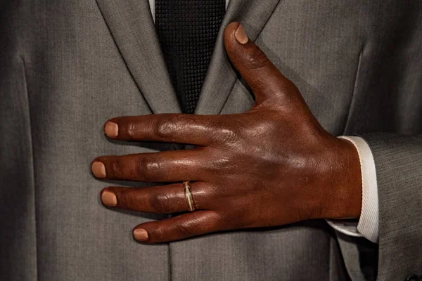 Μαύρος χέρι με το δαχτυλίδι του γάμου — Φωτογραφία Αρχείου