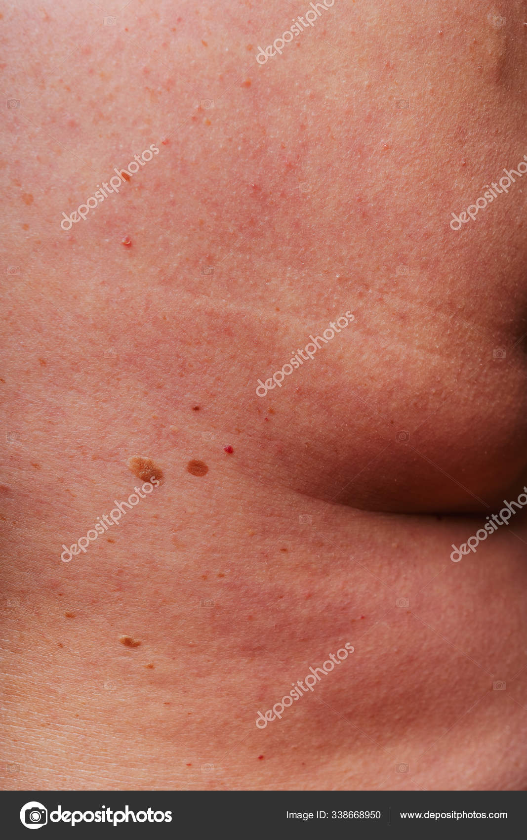 3 754 Age Spots Stock Photos Free Royalty Free Age Spots Images Depositphotos
