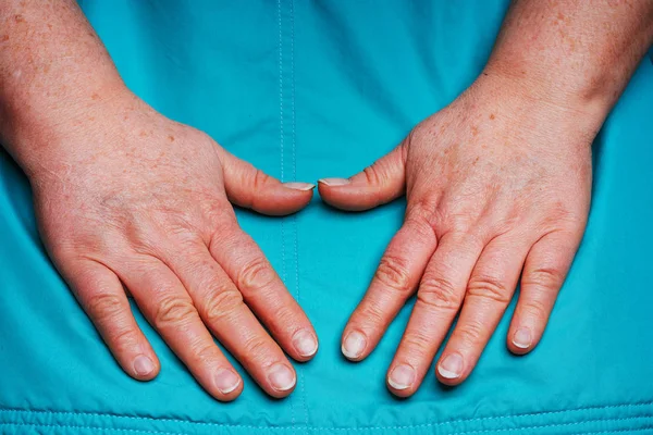 Las Manos Una Anciana Pigmentación Venas Sobresalientes Las Manos Las — Foto de Stock