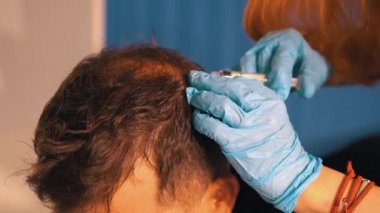 Kelliğe karşı saç yenileme prosedürü uygulayan genç bir adam. Erkeklerde erken kellik için mezoterapi. Yakın planda saç büyümesi için kafaya enjeksiyon prosedürü. Erken saç dökülmesine karşı mücadele