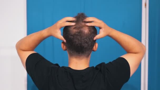 医務室にいたトリコロジストの指名ではげ頭の若い男 男性の早期脱毛のためのメソセラピー 男性の早期脱毛 男ははげ頭の上で手を動かす — ストック動画