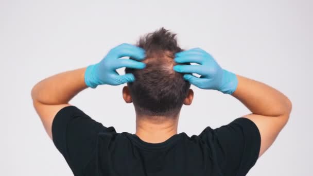 Jovem Careca Consulta Tricologista Consultório Médico Mesoterapia Para Calvície Precoce — Vídeo de Stock