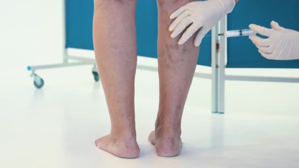 高齢者の女性の静脈のクローズアップショット 静脈瘤の女性の足の静脈への注射 静脈瘤の治療 放置された状態の老婦人の静脈 — ストック動画