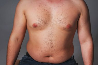 Overweight male torso. Naked torso of a man. Hair increased vegetation on the chest of a man clipart