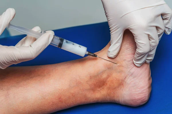 Injections into the veins of an elderly woman\'s leg close-up. Doctor\'s injections in the veins of an old woman\'s legs. Treatment of varicose veins. Varicose veins injections