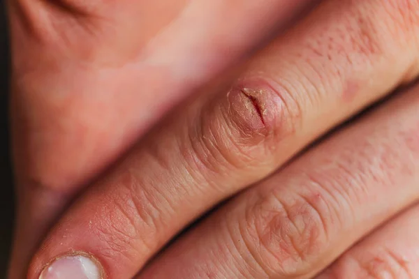 Dedos Dos Homens Fecham Dedos Sem Manicure Preparado Mãos Trabalhadores — Fotografia de Stock