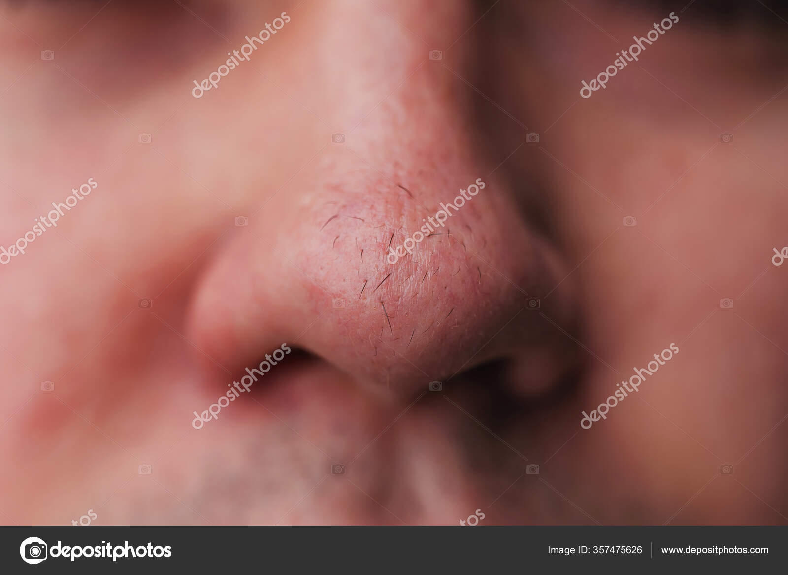 Man Nose Hair Close Hair Grows Surface Skin Nose Increased Stock Photo by  ©Kinderkz 357475626
