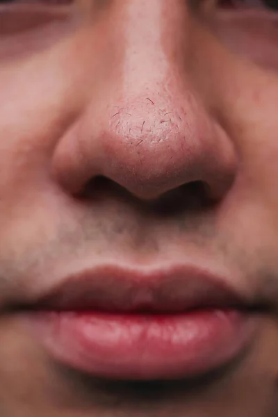 Man with nose hair close-up. Hair grows on the surface of the skin of the nose. Increased hairiness on the face. Hairy male fleshy nose close-up.