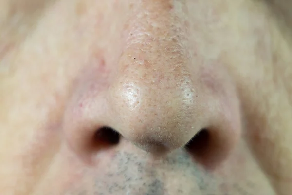 The man's nose is close-up. Pores in the skin. — Stock Photo, Image