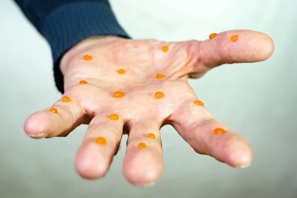 Viral infection transmitted through handshake.No handshake concept: Coronavirus transmitted through a handshake. Gesture No physical contact. Precautions and prevention of disease