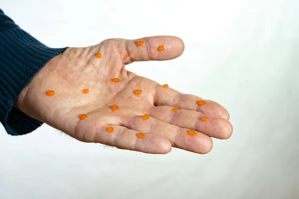 病毒感染是通过握手传播的 没有握手概念 结肠病毒是通过握手传播的 姿势不能有身体接触 预防和预防疾病 — 图库照片