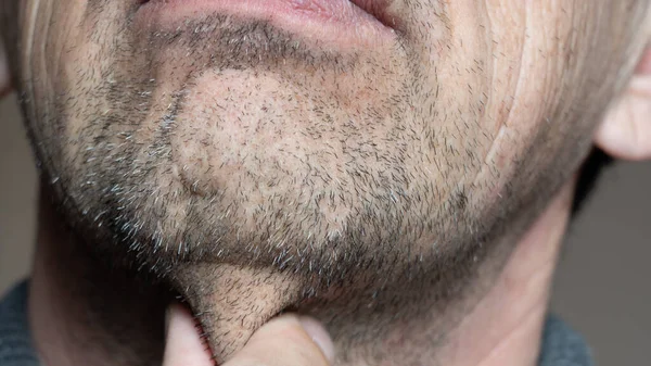 Chin Bristles Bearded Old Man Touches His Unshaven Face His — Stock Photo, Image