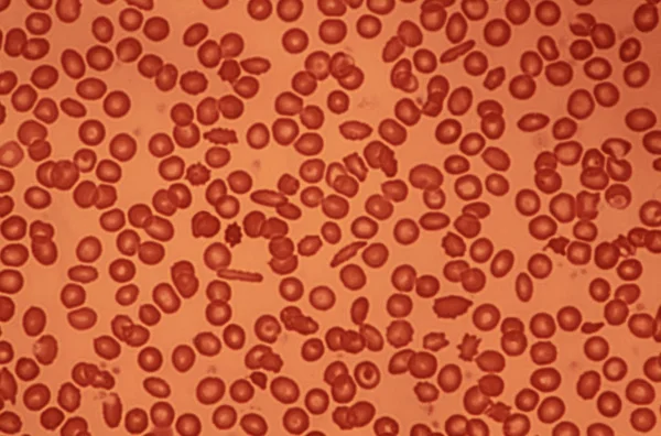 Insan kan hücreleri — Stok fotoğraf