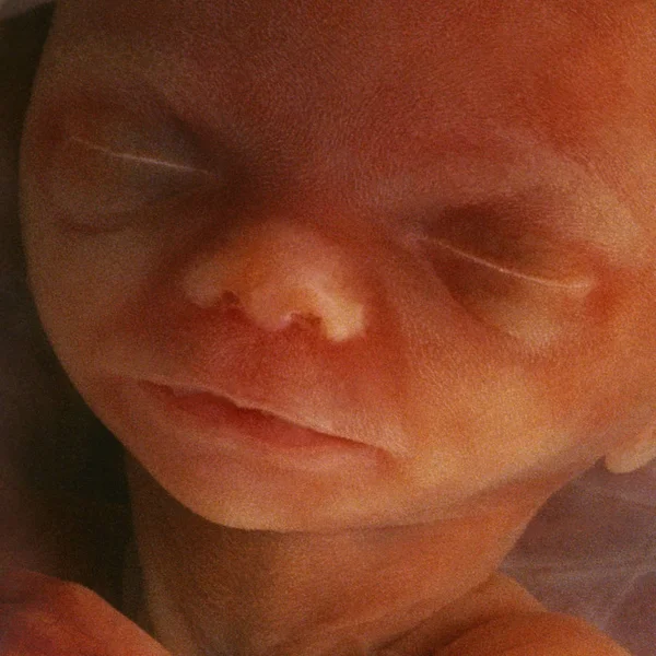 Imagem in vitro de um feto humano no útero — Fotografia de Stock