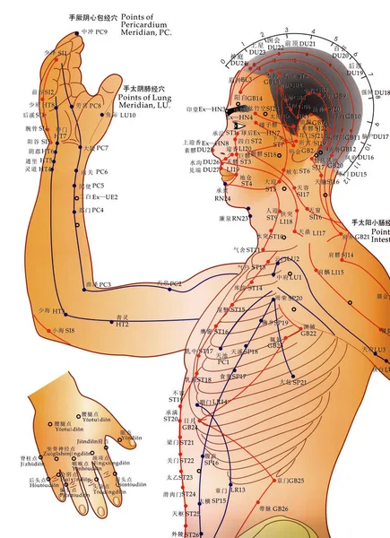 Médecine alternative - Tableau d'acupuncture — Photo