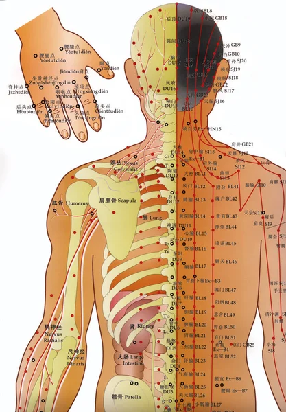 Médecine alternative - Tableau d'acupuncture — Photo
