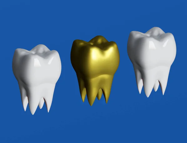 Dente Dourado Lado Dentes Brancos Dente Coroa Dourada Ilustração — Fotografia de Stock