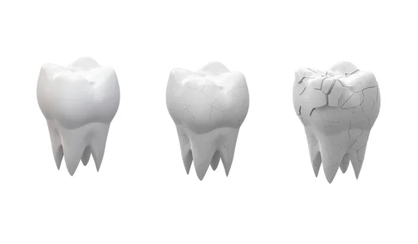 Σπασμένοι Γομφίοι Δόντι Και Ολόκληρο Δόντι Απομονώνονται Λευκό Φόντο Εικονογράφηση — Φωτογραφία Αρχείου