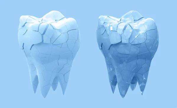 断了的牙齿和整个牙齿隔离在蓝色的背景 3D说明 — 图库照片