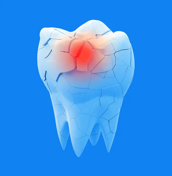 Kırık Azı Dişi Beyaz Arka Planda Izole Edilmiş Tüm Diş — Stok fotoğraf