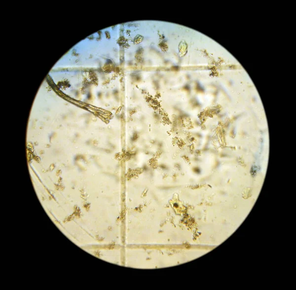 Sel Fitoplankton Gambar Diambil Dengan Mikroskop Optik Oleh Kamera Contoh — Stok Foto