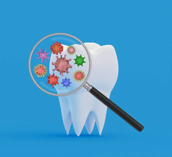 Tooth Bacteria Magnifying Glass Research Diagnosis Teeth Diseases Concept Tooth — Stock Photo, Image