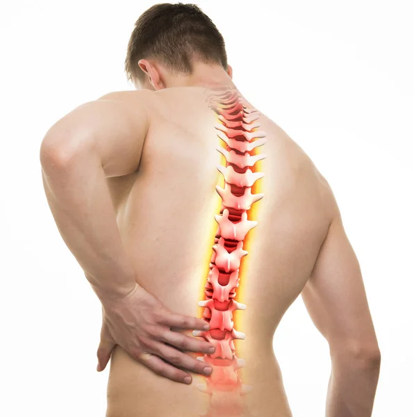Spine Injury - Studio shot with 3D illustration isolated on whit — Stock Photo, Image