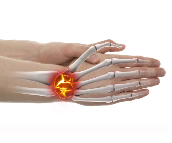 Wrist Pain - Studio shot with 3D illustration isolated on white — Stock Photo, Image