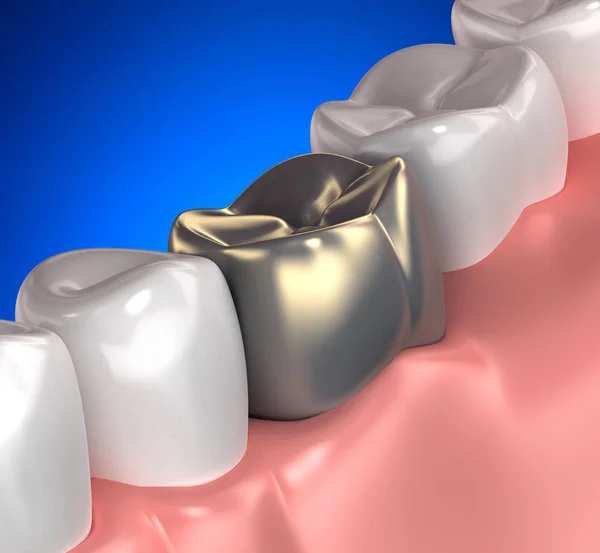 Золотые зубы рот анатомии синий - 3d иллюстрации — стоковое фото
