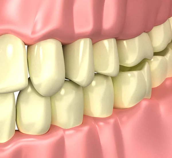 Концепция "Желтые плохие зубы курильщиков" - 3d иллюстрация — стоковое фото