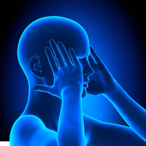 Frau mit Kopfschmerzen - 3d Illustration Stockfoto