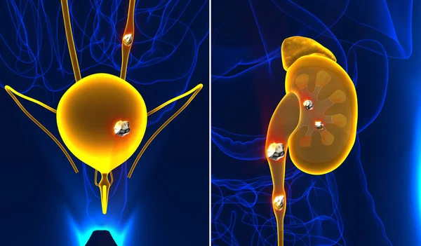 Calcoli renali e urinari anatomia dolore maschile organo internof — Foto Stock