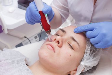 Deri altına serum girişi ile mezotari süreci