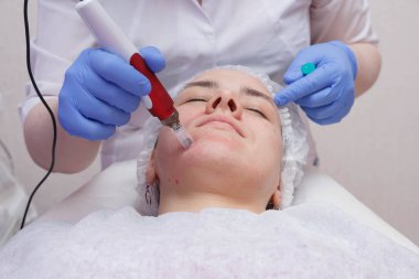 Deri altına serum girişi ile mezotari süreci