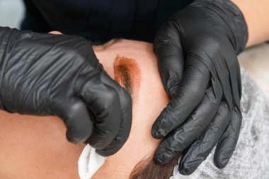 Usta, ameliyattan sonra fazla kaş makyajı boyasını kaldırır. Kalıcı Kaş Makyajı Prosedürü.