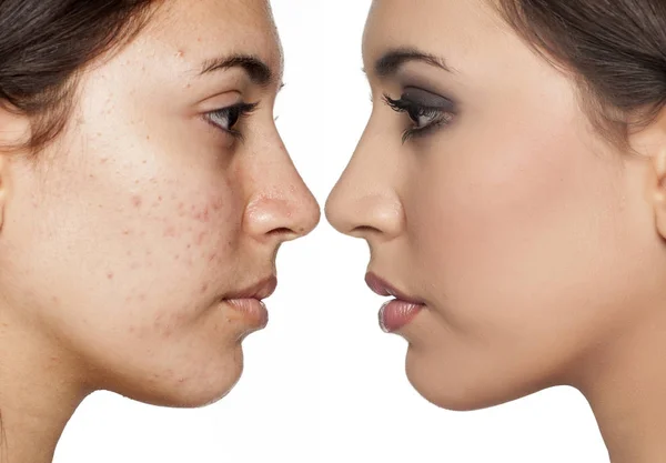 Antes y después del maquillaje — Foto de Stock