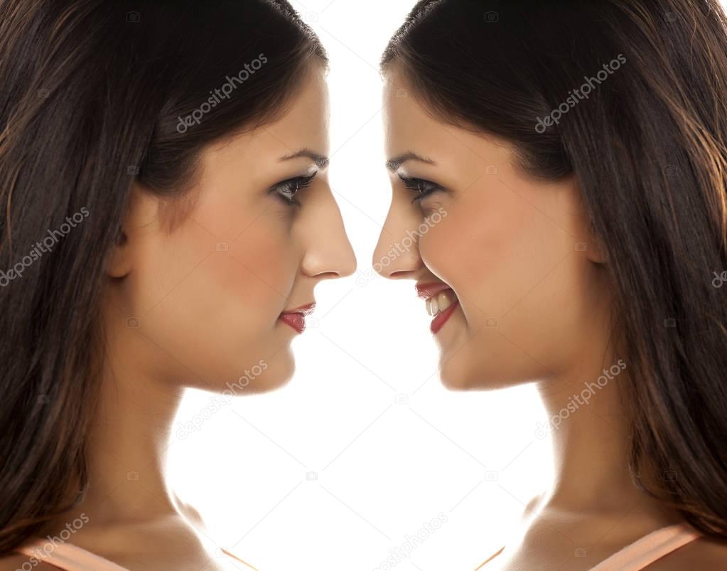 rhinoplasty before and after