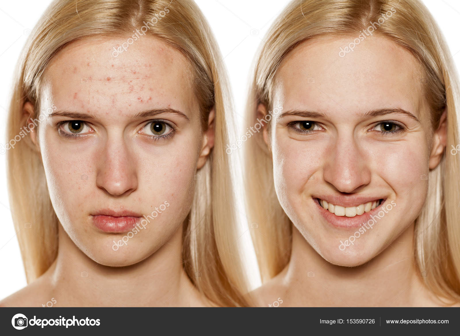 Skin care cosmetic treatment — Stock Photo © 153590726
