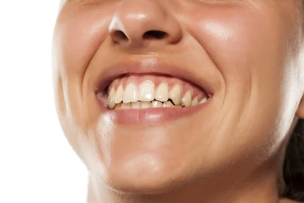 Žena s krásné zuby — Stock fotografie