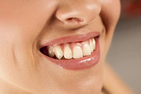 Žena s krásné zuby — Stock fotografie