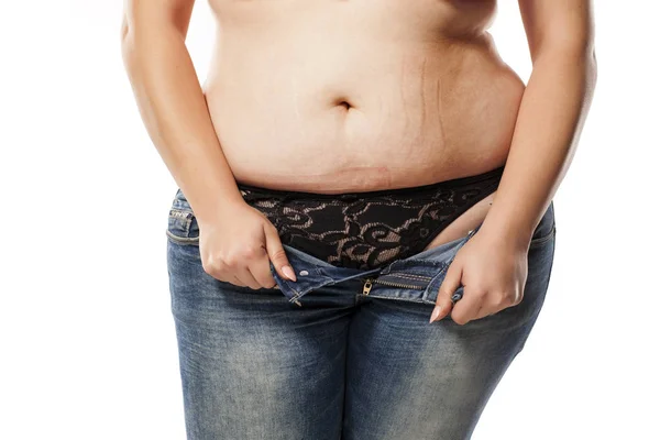 Mujer obesa en jeans — Foto de Stock